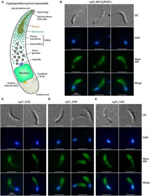 Discovery of New Microneme Proteins in Cryptosporidium parvum and Implication of the Roles of a Rhomboid Membrane Protein (CpROM1) in Host–Parasite Interaction